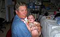 People & Humanity: Macey and Mackenzie Garrison, conjoined twins