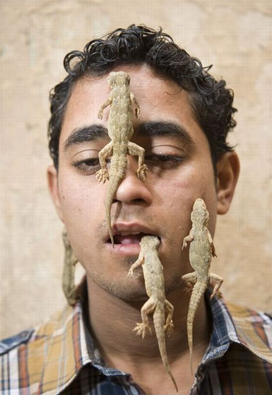 Man lizard, India, 21 years old