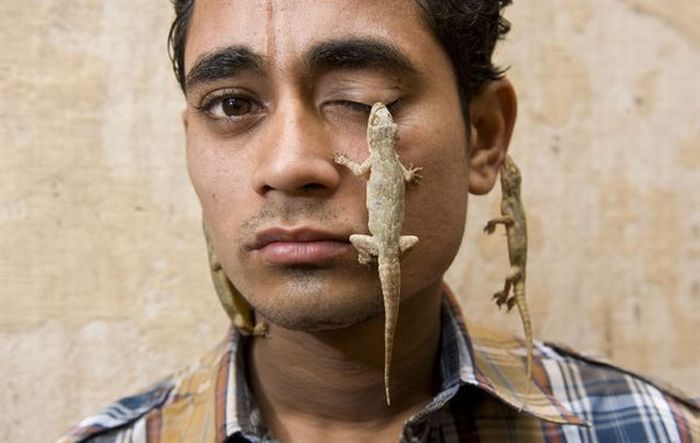 Man lizard, India, 21 years old