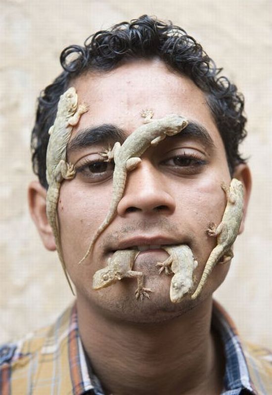 Man lizard, India, 21 years old