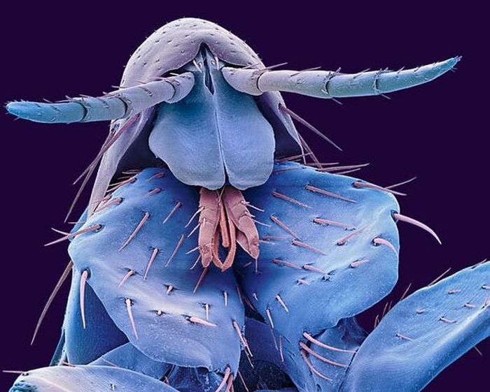 insect under the microscope