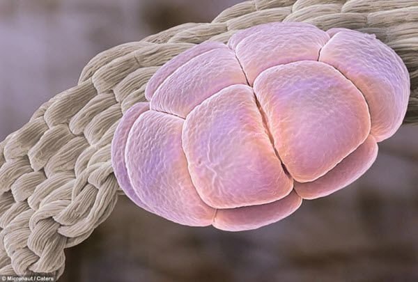 pollen allergies under microscope