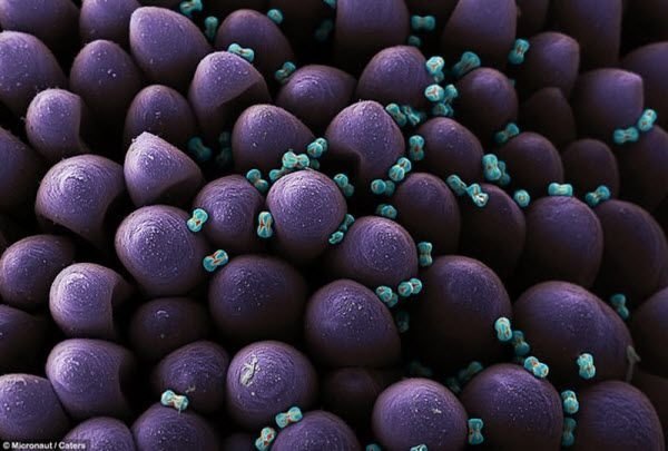 pollen allergies under microscope