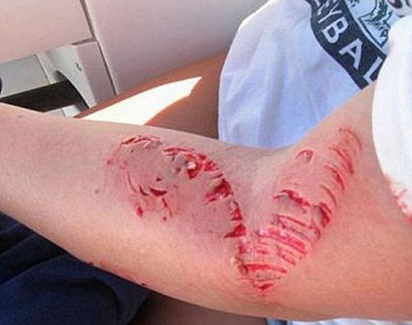 barracuda attacked a 14-year-old girl