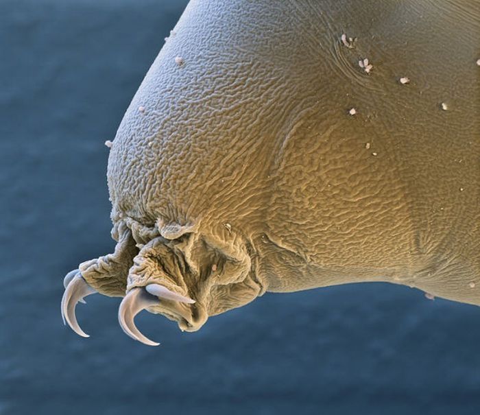 Tardigrades