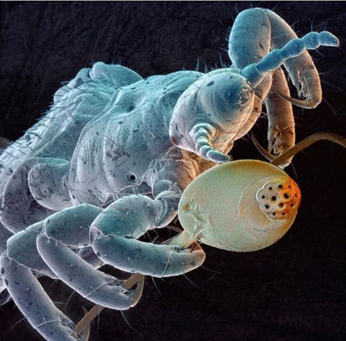 house dust mite