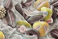 TopRq.com search results: pollen allergies under microscope