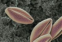 TopRq.com search results: pollen allergies under microscope