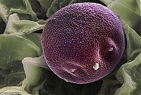 TopRq.com search results: pollen allergies under microscope