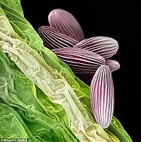 Fauna & Flora: pollen allergies under microscope