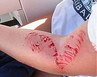 Fauna & Flora: barracuda attacked a 14-year-old girl
