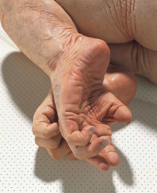 Works by Patricia Piccinini