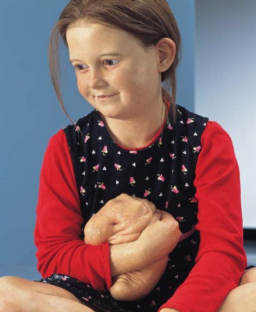 Works by Patricia Piccinini