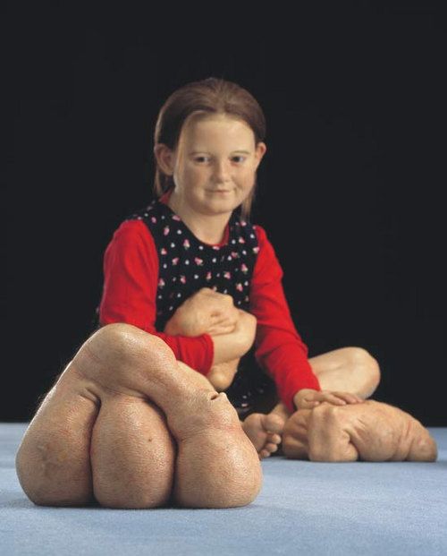 Works by Patricia Piccinini