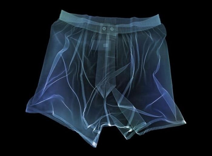 x-ray picture