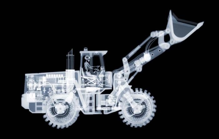 x-ray picture