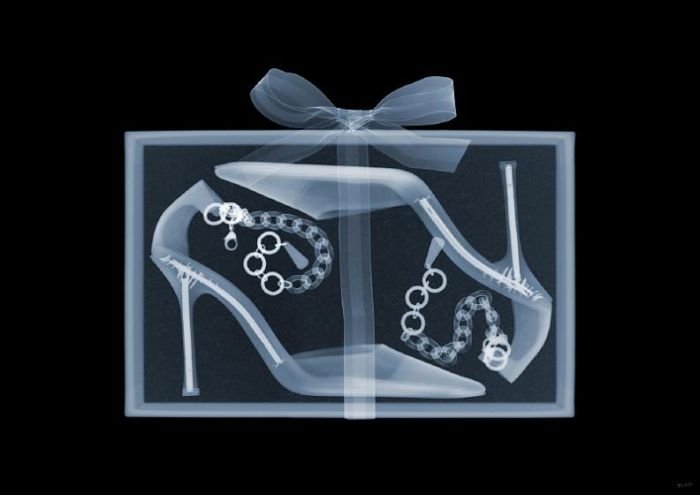 x-ray picture