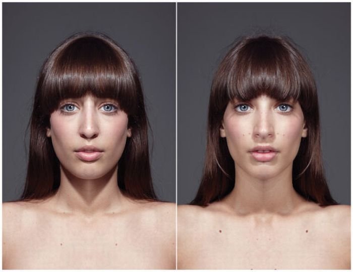 echoism, facial symmetry