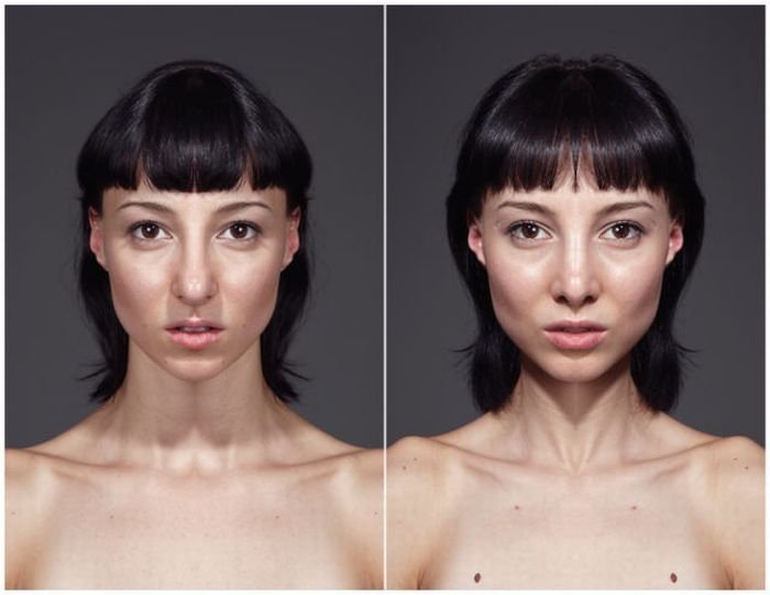 echoism, facial symmetry