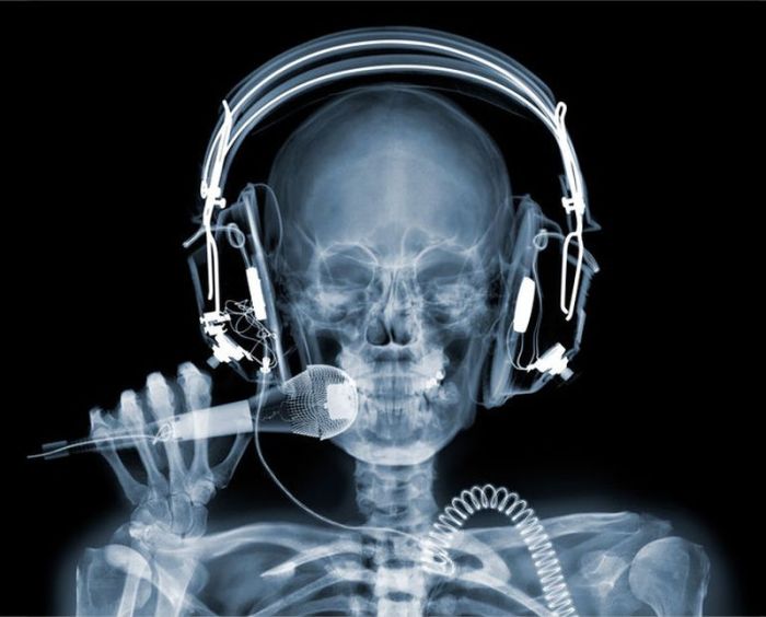 X-ray images by Nick Veasey