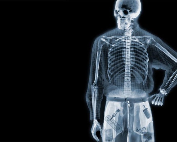 X-ray images by Nick Veasey