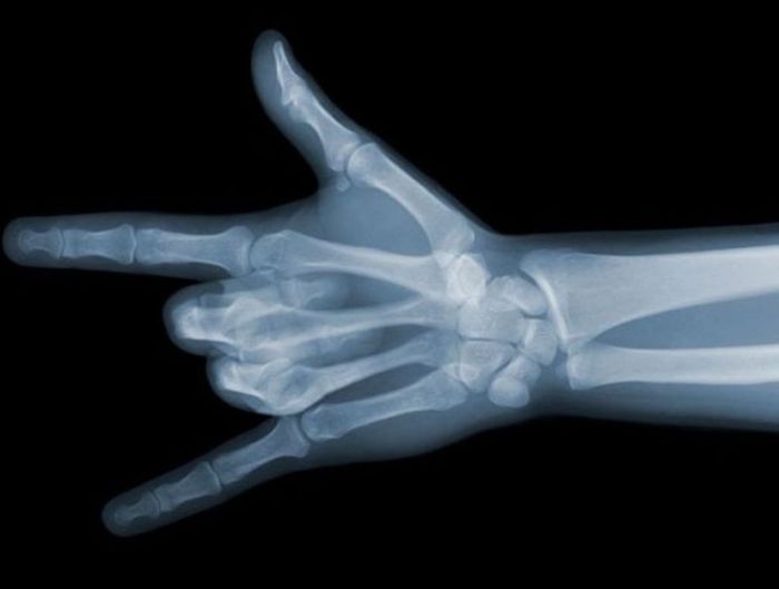 X-ray images by Nick Veasey