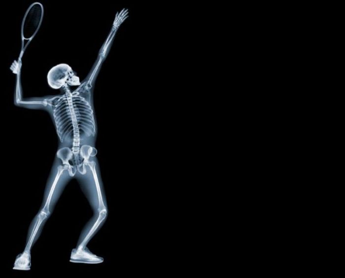 X-ray images by Nick Veasey