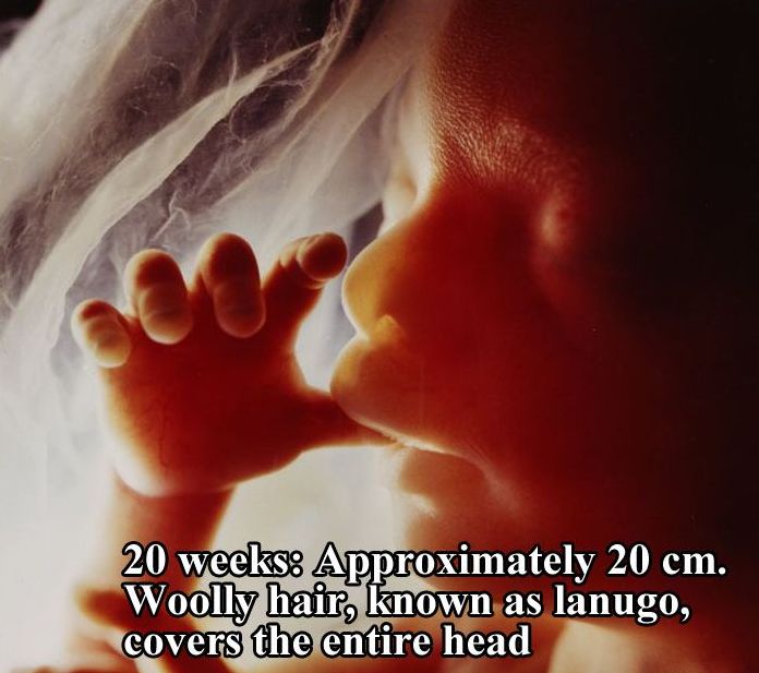 A Child Is Born by Lennart Nilsson