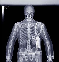 Art & Creativity: x-ray picture