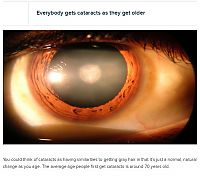 TopRq.com search results: interesting facts about eyes