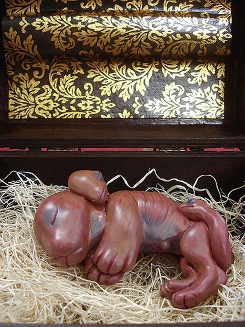 chimera fetus box