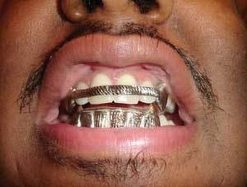 teeth holder jewelry around the world