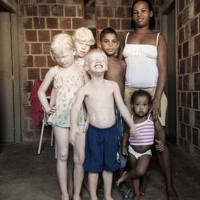 Family of black Brazilians had three albinos, Pernambuco, Brazilia