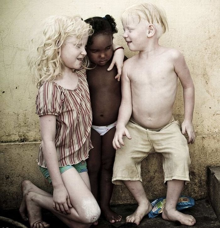 Family of black Brazilians had three albinos, Pernambuco, Brazilia