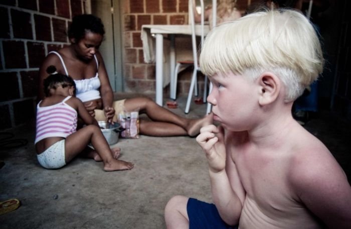 Family of black Brazilians had three albinos, Pernambuco, Brazilia