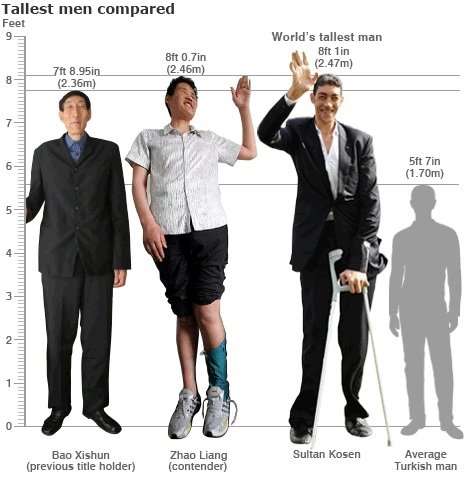 Sultan Kosen, Tallest man in the world, 2 meters 47 centimeters, Turkey