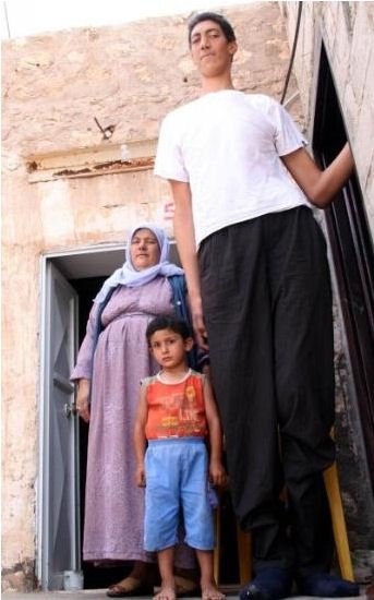 Sultan Kosen, Tallest man in the world, 2 meters 47 centimeters, Turkey