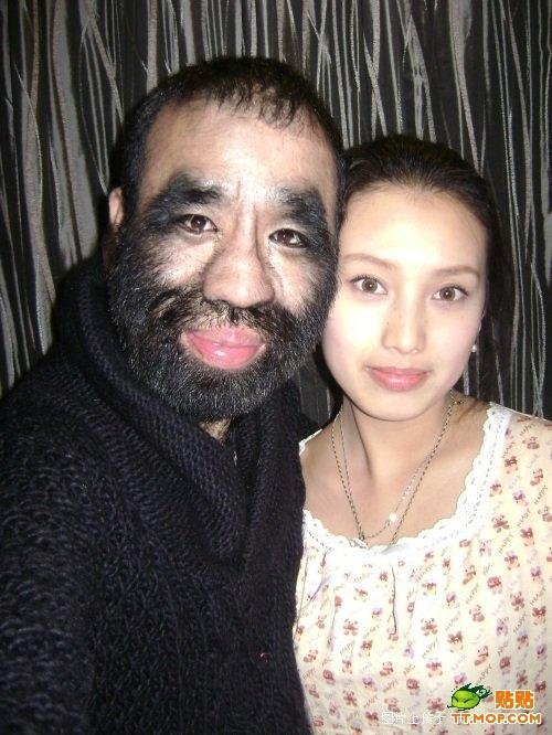 The most hairy man, China