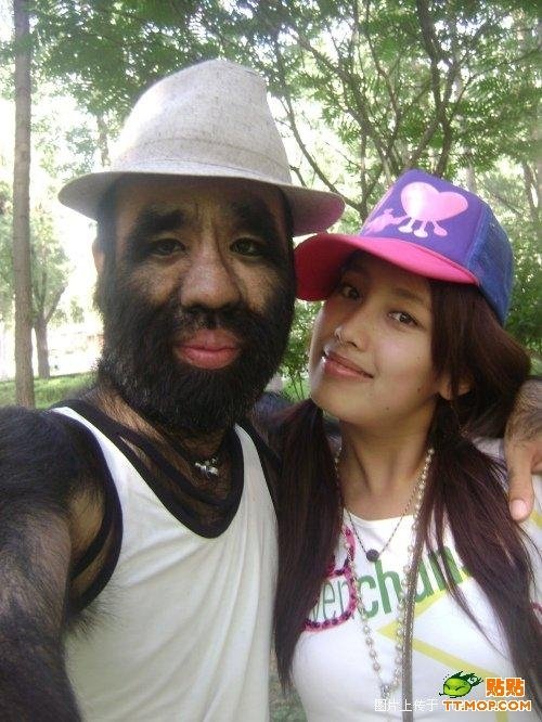 The most hairy man, China