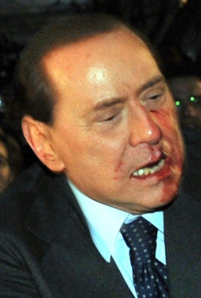 Silvio Berlusconi, Massimo Tartaglia hit and intentionally injure Prime Minister of Italy, Sunday, Milan, Italy