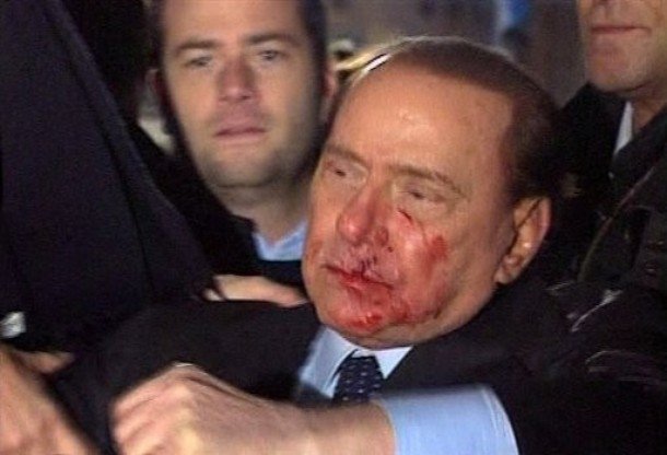 Silvio Berlusconi, Massimo Tartaglia hit and intentionally injure Prime Minister of Italy, Sunday, Milan, Italy