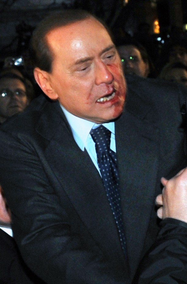 Silvio Berlusconi, Massimo Tartaglia hit and intentionally injure Prime Minister of Italy, Sunday, Milan, Italy