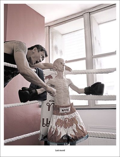 Leon Botha with rare disease Progeria