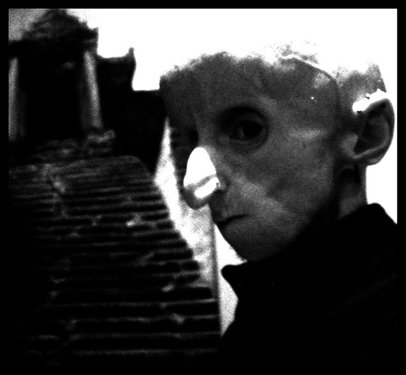 Leon Botha with rare disease Progeria
