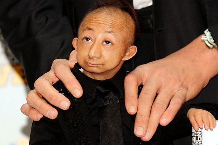 He Pingping, world's shortest man died