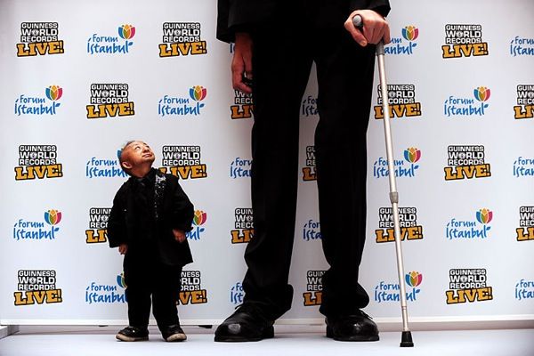 He Pingping, world's shortest man died
