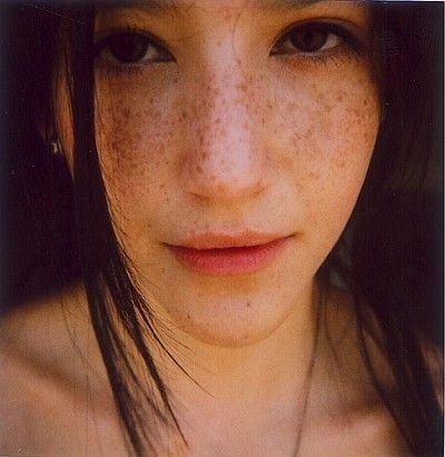 freckled girl