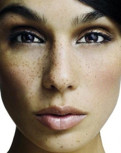 freckled girl