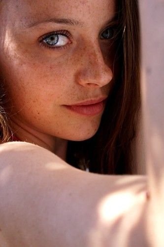 freckled girl