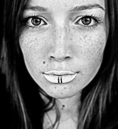 freckled girl